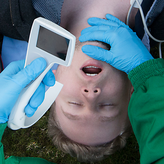 Видеоларингоскоп i-view