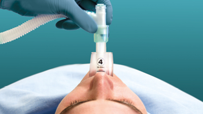 Обеспечение проходимости дыхательных путей