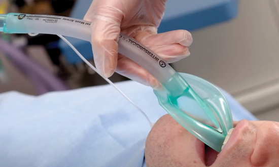 Представляем линейку ларингеальных масок Intersurgical