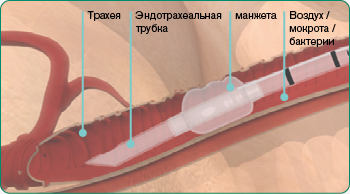 explore-image-oral-care-vap-facts-3-RU